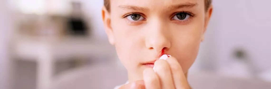 Krwawienia z nosa u dzieci - Czasopismo dla lekarzy pediatrów | Forum